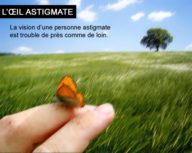 l'oeil astigmate
