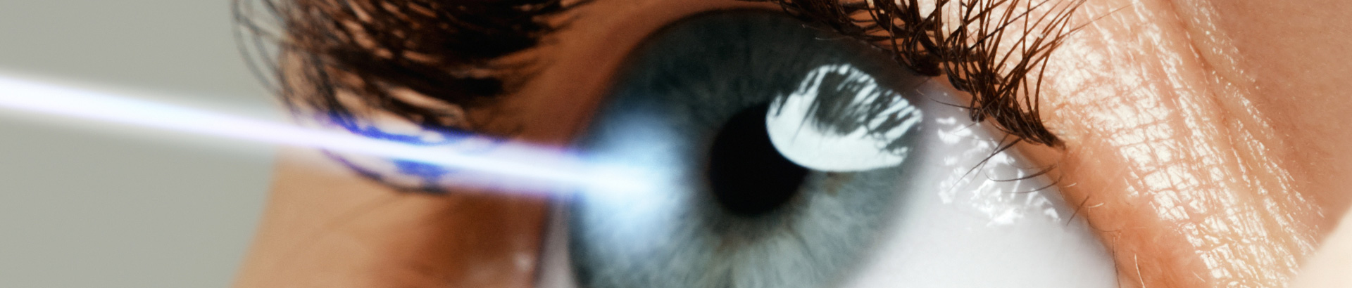 Opération de la myopie