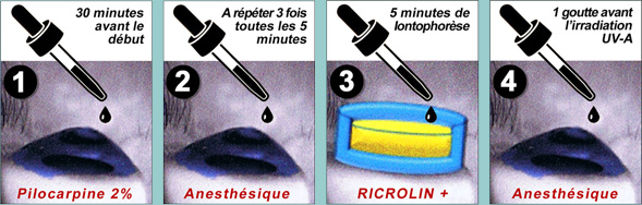 La technique du cross-linking