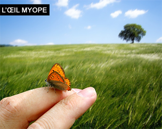 l'oeil myope